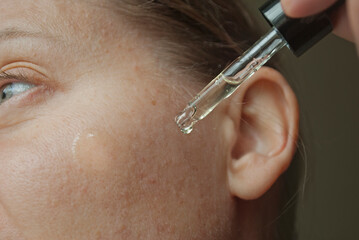 Close-up of a woman applying serum from an eyedropper, a woman in her forties and older.
