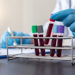 Scientists or physicians analyze the blood sample in vitro to prepare a vaccine against a new...