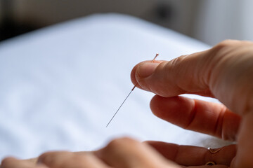 Profesional woman giving acupuncture treatment. High quality photo