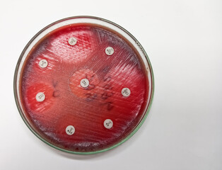 Antimicrobial susceptibility testing in petri dish. Antibiotic sensitive and resistance of bacteria.