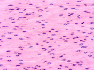 Histology of human tissue, show  epithelial tissue and connective tissue with microscope view  from...