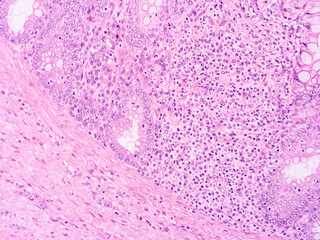 Histology of human tissue, show  epithelial tissue and connective tissue with microscope view  from laboratory (not Illustration Designation)