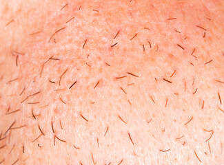 Hair on the skin of a man's face. Macro