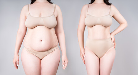 Woman's body before and after weight loss or liposuction on gray background