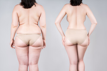Woman's body before and after weight loss or liposuction on gray background, fat and thin female...