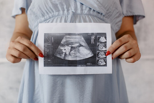 Pregnant woman holds ultrasound baby image. Close-up photo of ultrasound image on the background of a pregnant belly in the hands of mother. The concept of pregnancy.