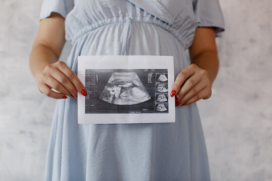 Pregnant woman holds ultrasound baby image. Close-up photo of ultrasound image on the background of a pregnant belly in the hands of mother. The concept of pregnancy.