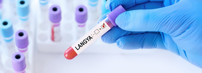 Obraz premium Doctor holding a test blood sample tube with positive Langya henipavirus (LayV) on the background of medical test tubes .The virus is transmitted from animals to humans.Banner. Copy space for text.