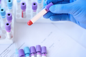 Hand with medical glove of doctor holds test tube with blood sample and blank label for own text on the background of medical test tubes.