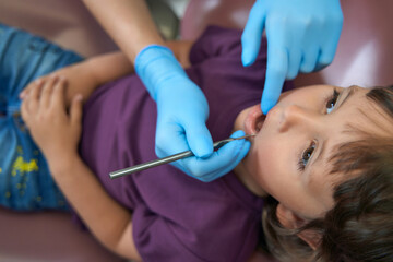 Obraz na płótnie Canvas Pedodontist examining female child teeth with diagnostic tool