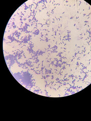 Microbiological fixed preparation of lactic acid bacteria of bacillary form stained with gentian...