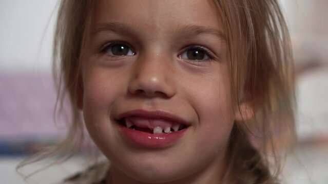 Close-up smile of girl. A beautiful little girl 6-7 years old has lost milk teeth. Loss of milk teeth, replacement of permanent teeth. Happy Smilling Children is dentistry. White teeth Face. Dentist