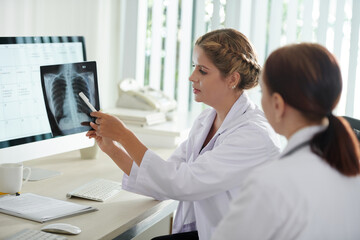 Pulmonologists Discussing Lungs X-ray