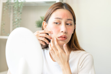 Fototapeta premium Dermatology, scratch asian young woman looking at mirror, expression worry and itch, itchy allergy or allergic sensitive reaction, red spot or rash on her face. Beauty care from skin problem treatment