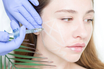 The cosmetologist draws contours with a white pencil on the patient's face. Schematic marking...
