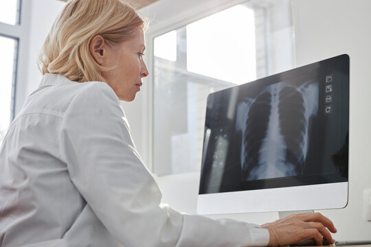 Doctor analyzing X-ray image on desktop PC in clinic