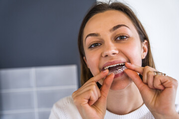 Smiling female putting at mouth teeth whitening tray