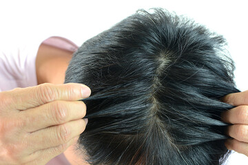 White hair problems in men, asian man with white hair, white hair or hair loss problem.