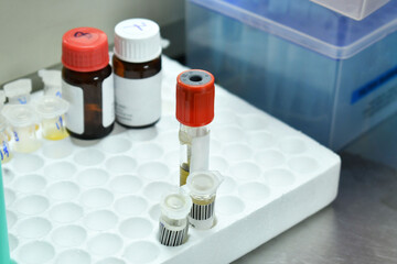 Tubo para muestra de Sangre, reactivos y accesorios de laboratorio clinico. Concepto de Salud.