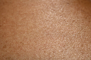 close up of skin color and texture