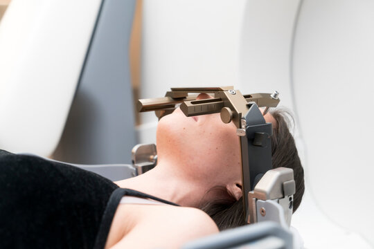 The Patient Lies In Front Of The Device For The Treatment Of Cancer With A Gamma Knife. She Has A Metal Clip Cap On His Head.