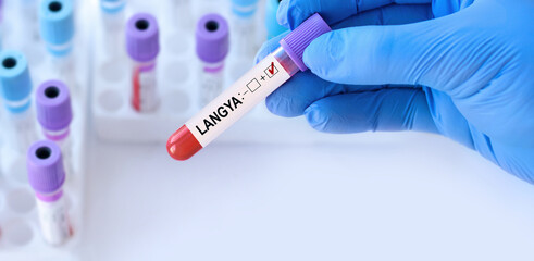 Doctor holding a test blood sample tube with positive Langya henipavirus (LayV) on the background...