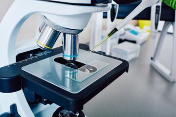 Microscopic urinalysis. Research of urine test sample under medical microscope in laboratory,...
