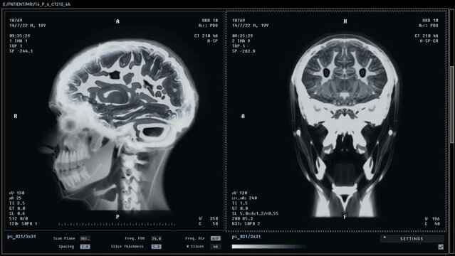Medical Equipment Scans Patient Head For Brain Injury Diagnosis. Healthcare Clinic Equipment Interface. Injury Scan By X-Ray Examination Equipment. Organ Injury Scan. Radiology. Skeleton. Diagnostic