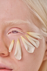 Close-up of albino girl with blue eyes and flower petals on her natural face skin - obrazy, fototapety, plakaty