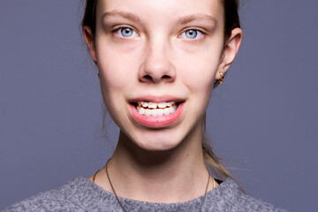 A young girl shows off dental braces.