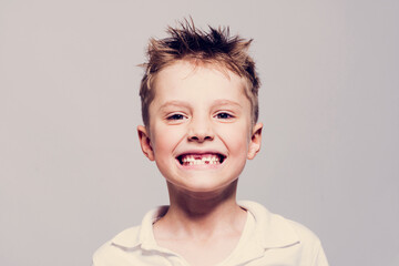 A little boy demonstrates the absence of teeth on a mesh background.