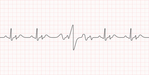 Electrocardiogram. Heart beat. Medical healthcare symbol