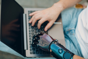 Young disabled man with artificial prosthetic hand using typing on laptop computer keyboard