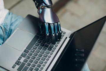 Young disabled man with artificial prosthetic hand using typing on laptop computer keyboard