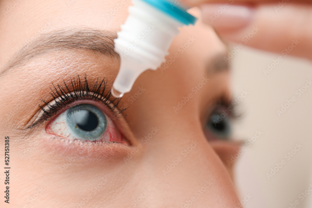 Wall mural Closeup view of woman using eye drops