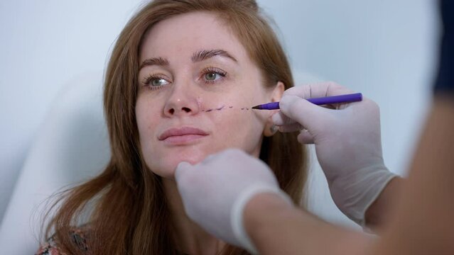 Close-up face of woman with doctor hand drawing markings for facelift procedure. Beautiful Caucasian female patient consulting expert plastic surgeon indoors looking up
