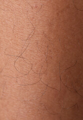 Human skin texture background,brown skin