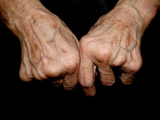 Hands of an old lady with veins and traces of long life
