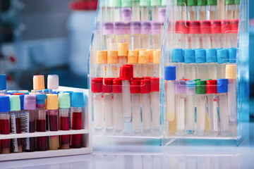 Blood sample test collection in the room work table with tube racks. Rack with blood samples from patients in the hematology laboratory