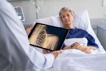 Doctor examining patient x-ray - obrazy, fototapety, plakaty