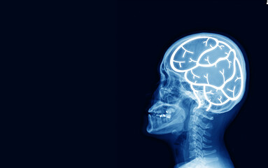 Obraz premium x-ray of human cervical spine and head skull .The sella turcica looks narmal.Medical image concept.