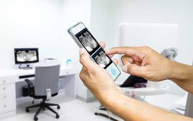 Close-up hand uses smartphone to check ultrasound abdomen online, Modern medical equipment. An ultrasound machine and a couch,Medical technology concept.