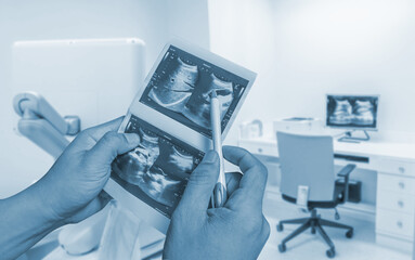 The doctor holding an ultrasound abdomen report is watching the ultrasound room patient in the hospital. Medical image concept.