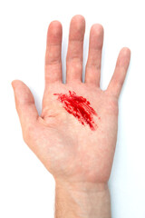 Man cut his hand and is bleeding. Accident. Top view. Failure to comply with safety regulations.