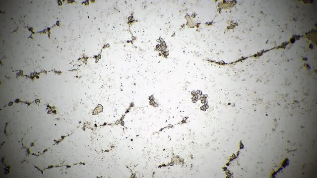 Whole mount of Taenia solium eggs under microscope on white background with 40 times magnification. Macro view of pork tapeworm on scientific slide for studying. Parasites in environment. Pests theme