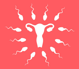 Multiple sperms are heading to fertile uterus and womb with ovaries. Competition of male reproduction during fertilization and impregnation to impregnate and fertilize. Vector illustration.