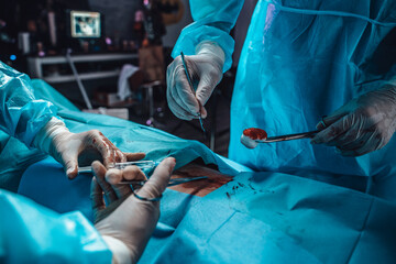 Shot of modern treatment of surgeons specialists taking abdominal incision in operating room.
