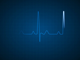 Blue ECG EKG Diagram of a Healthy Heart