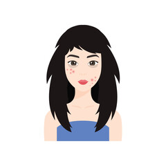 Beautiful Asian Woman with Problem Skin on Face. Pimples and Dark Circles Under her Eyes. Japanese Lady with Bad Damaged Hair. Unkemptness. Color Cartoon style. White background. Vector illustration.