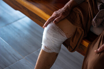 Fototapeta na wymiar The wound was caused by a fall. An old woman has a wound on knee.